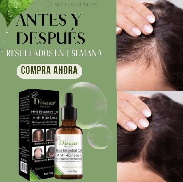 🌟 TRANSFORMA TU CABELLO CON EL PACK SHAMPOO Y SERUM ANTICAÍDA JENGIBRE 🌿: